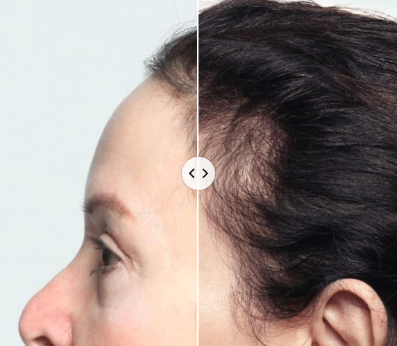 BUY 1 GET 1 FREE - Hot Sale Ginger Plant Extract Anti-Hair Loss Hair Shampoo