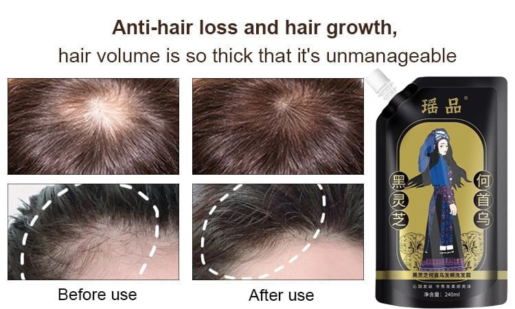 BUY 1 GET 1 FREE - Hot Sale Ginger Plant Extract Anti-Hair Loss Hair Shampoo