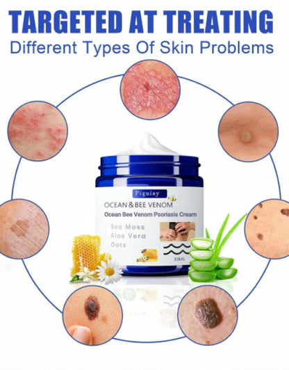 Bee Venom &Ocean Psoriasis Healing Cream ( Pack Of 2 )